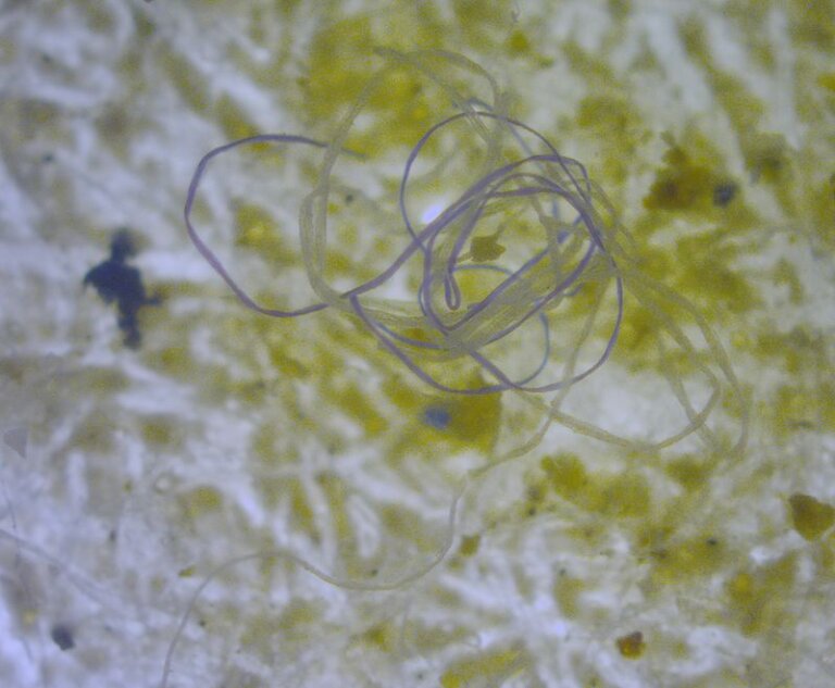 Mikroplastik