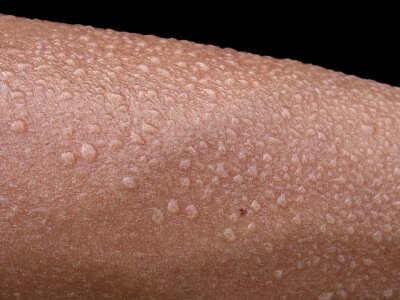 Sztuczna Inteligencja przeanalizuje skład potu i zaalarmuje na czas